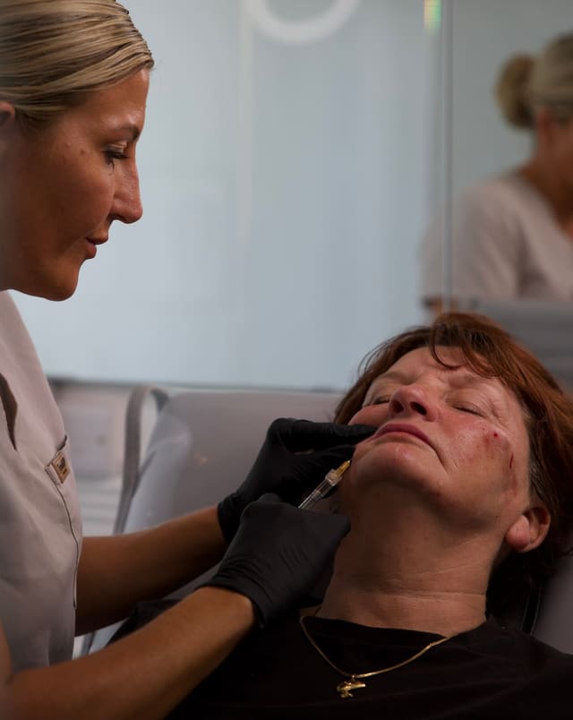 Close-up of a lip filler treatment being carried out at Maldiva Aesthetics